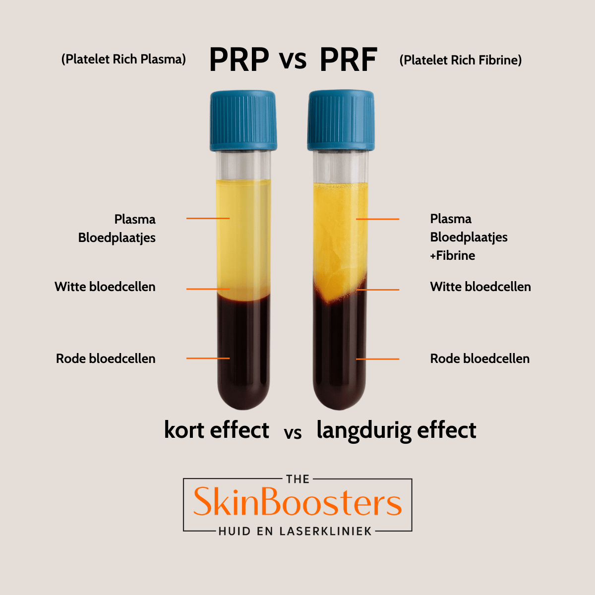 PRP vs PRF 20250818