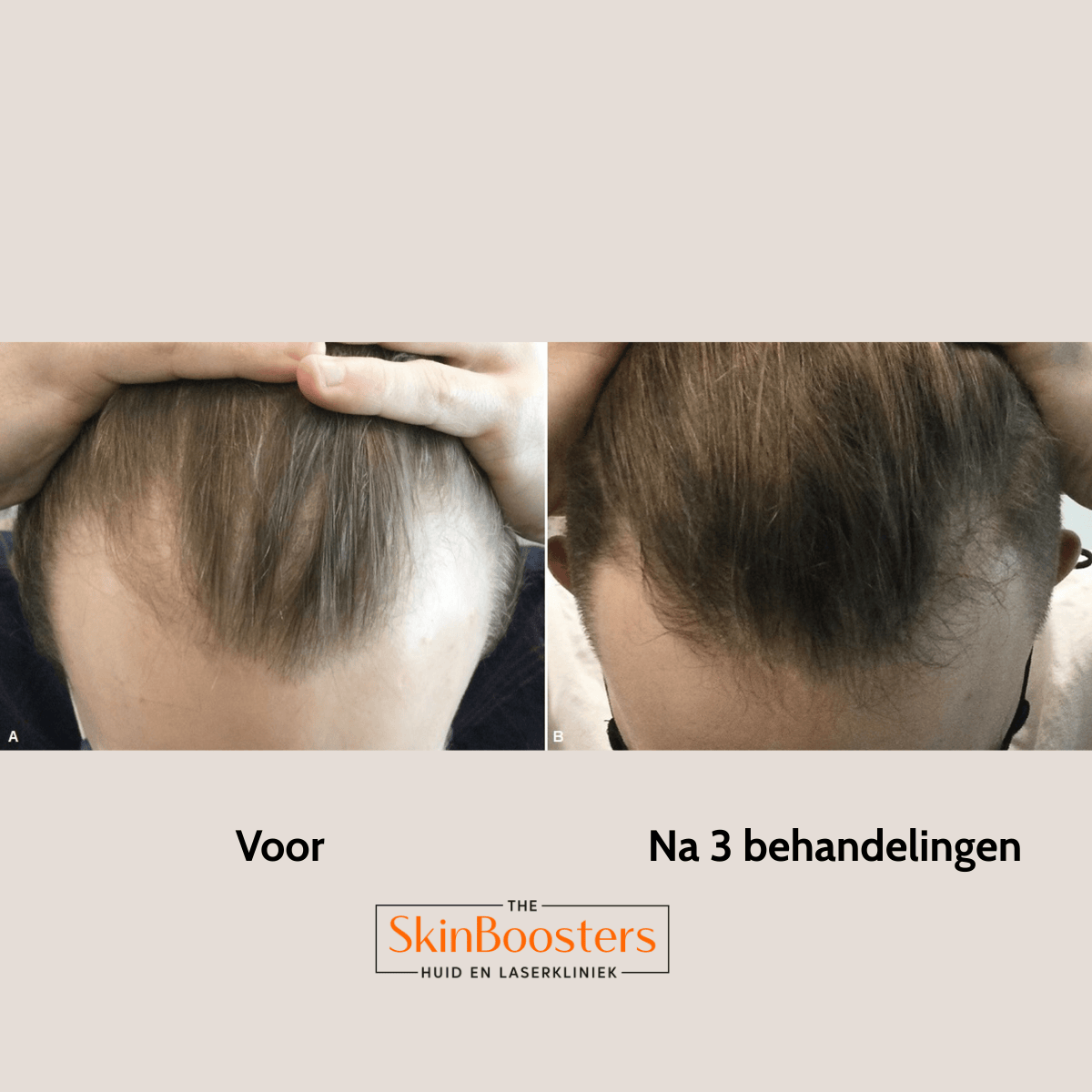 TSB WEBSITE FOTO SQUARE Fresco (19)